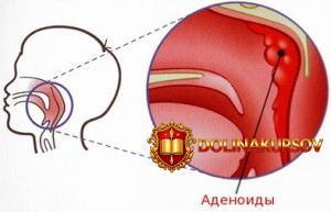 adenoidy-kaznit-nelzja-pomilovat-ledneva.20144.jpg