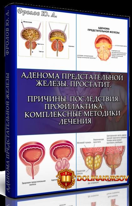 mini-infoprodukt-no4-adenoma-predstatelnoj-zhelezy-prostatit-prichiny-posledstvija-profilaktik...jpg